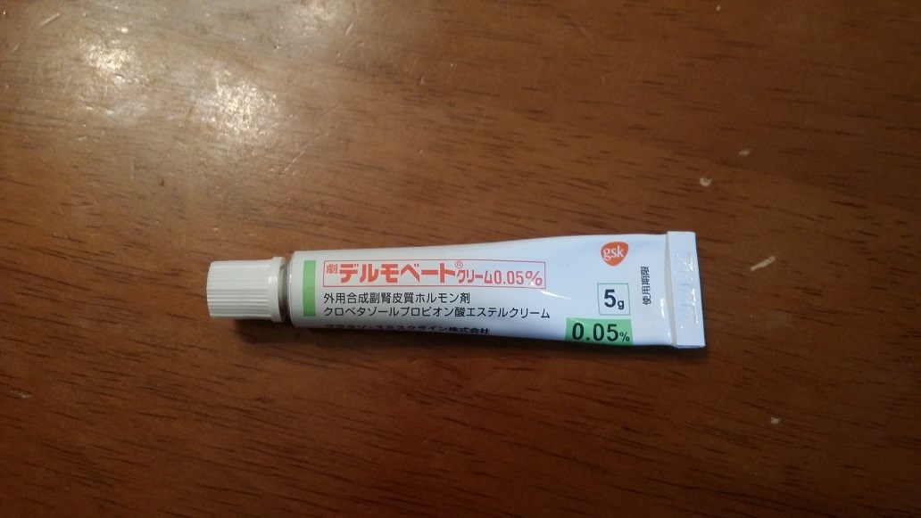 ハチに刺されました スタッフ日記 タイヤ館 真正 岐阜県のタイヤ カー用品ショップ タイヤからはじまる トータルカーメンテナンス タイヤ館グループ